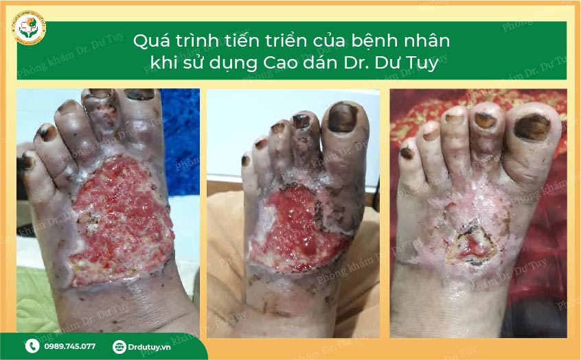 tai nạn giao thông