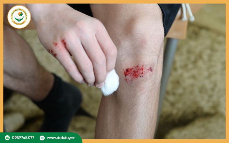 Nguyên nhân vết thương lâu lành?