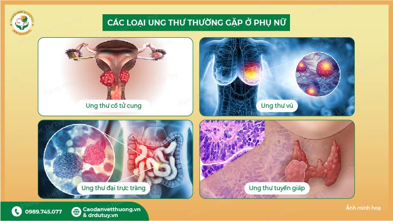 tầm soát ung thư cổ tử cung