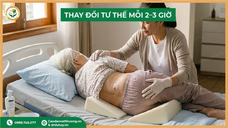 thay đổi tư thế mỗi 2-3 giờ khi vùng cùng cụt bị đỏ