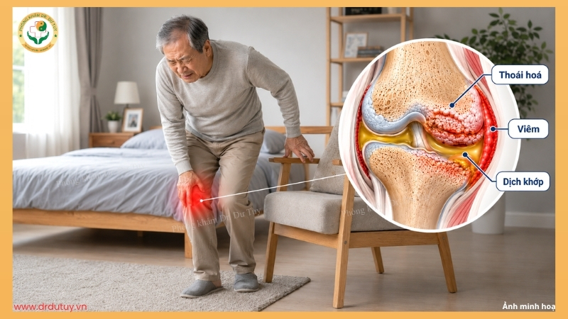 thoái hoá viêm và tràn dịch khớp gối ở người cao tuổi