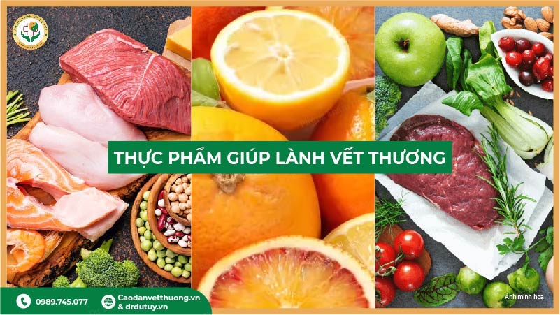 thực phẩm giúp lành vết loét
