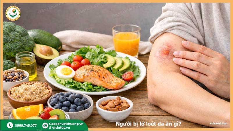 thực phẩm hỗ trợ lành vết loét da