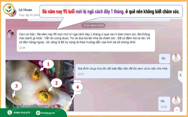 thuốc tạo màng vết loét