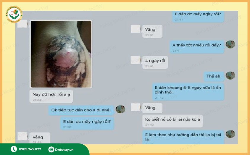 thuốc trị áp xe nách