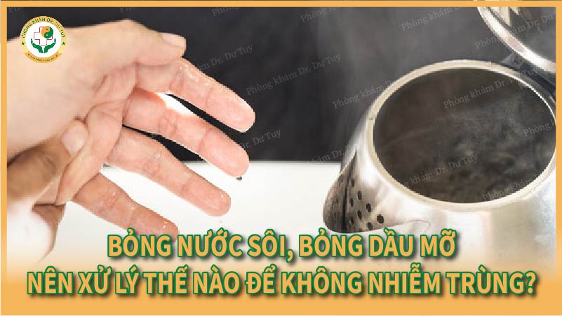 Bỏng nước sôi, bỏng dầu mỡ – nên xử lý thế nào để không nhiễm trùng?