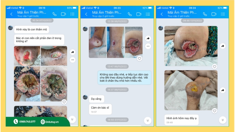 thuốc trị lở loét cho người già của nhất