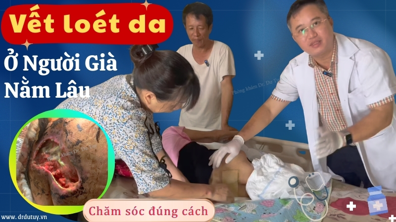 Vết loét da ở người già nằm lâu: Nguyên nhân, dấu hiệu và cách chăm sóc đúng cách