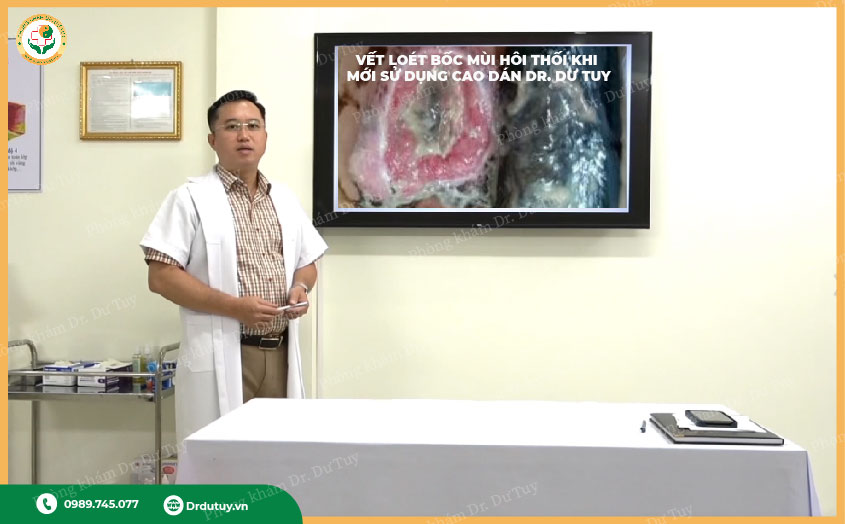 thuốc trị lở loét ngoài da