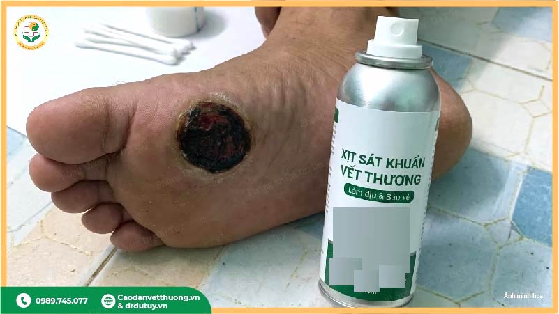 thuốc xịt sát khuẩn vết thương