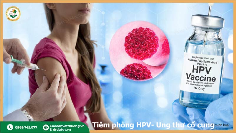 tiêm vacxin HPV phòng sùi mào gà