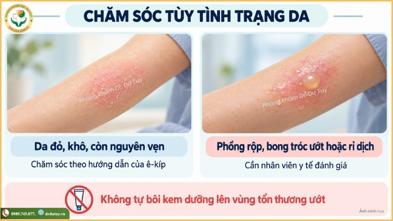 tình trạng da sau xạ trị