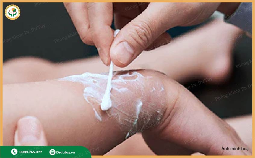 trẻ bị bỏng nước sôi