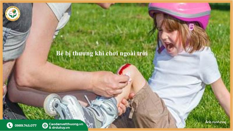 trẻ bị trầy xước khi chơi ngoài trời cần làm sạch sớm