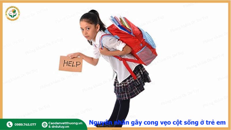 trẻ đeo balo nặng gây cong vẹo cột sống