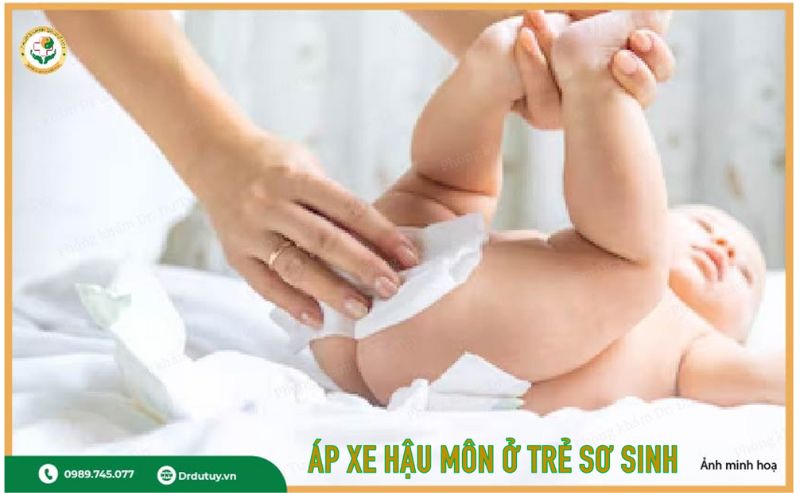 trẻ sơ sinh bị áp xe hậu môn