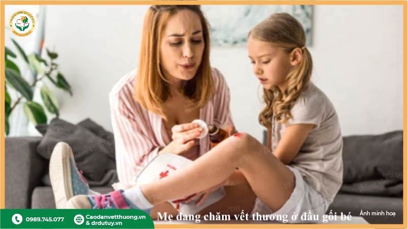 trẻ té ngã trầy xước mẹ sơ cứu vết thương