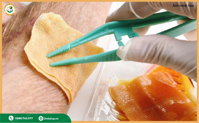 trị vết loét ngoài da