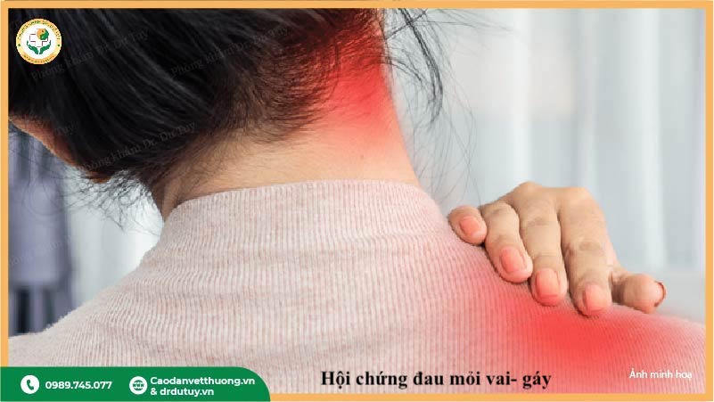 triệu chứng đau mỏi xương khớp phụ nữ sau 35