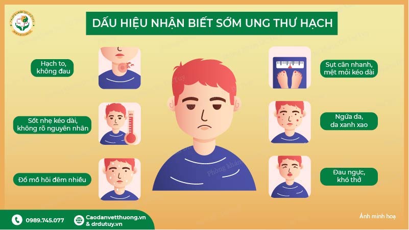 triệu chứng nhận biết ung thư hạch