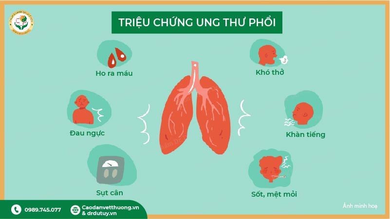 triệu chứng ung thư phổi ho ra máu, khó thở