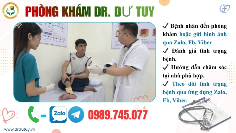 tư vấn áp xe qua Zalo