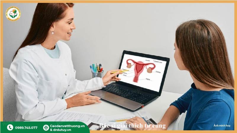 tư vấn siêu âm buồng trứng đa nang pcos
