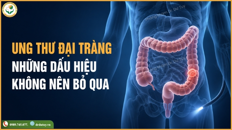Nguyên nhân, triệu chứng và phương pháp điều trị ung thư đại tràng
