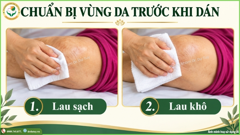 vệ sinh da trước khi dán cao khớp gối