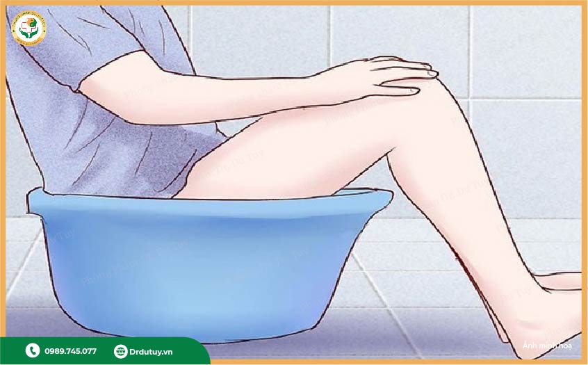 vệ sinh sau mổ rò hậu môn