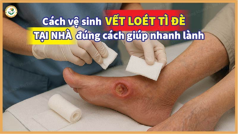 Cách vệ sinh vết loét tì đè tại nhà đúng cách giúp nhanh lành
