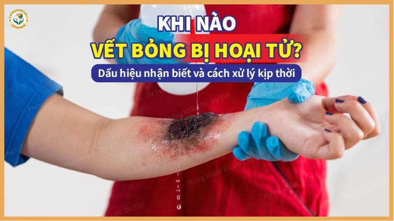Khi nào vết bỏng bị hoại tử? Dấu hiệu nhận biết và cách xử lý kịp thời