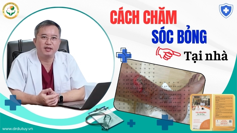 Bị bỏng ngoài da nên làm gì? Cách xử lý đúng để nhanh lành, hạn chế để lại sẹo