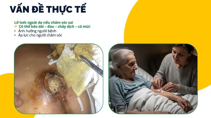 vết loét ngoài da lâu lành chảy dịch có mùi