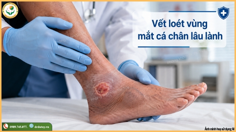 vết loét quanh mắt cá chân lâu lành
