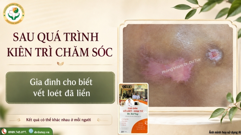 vết loét sau quá trình chăm sóc kiên trì