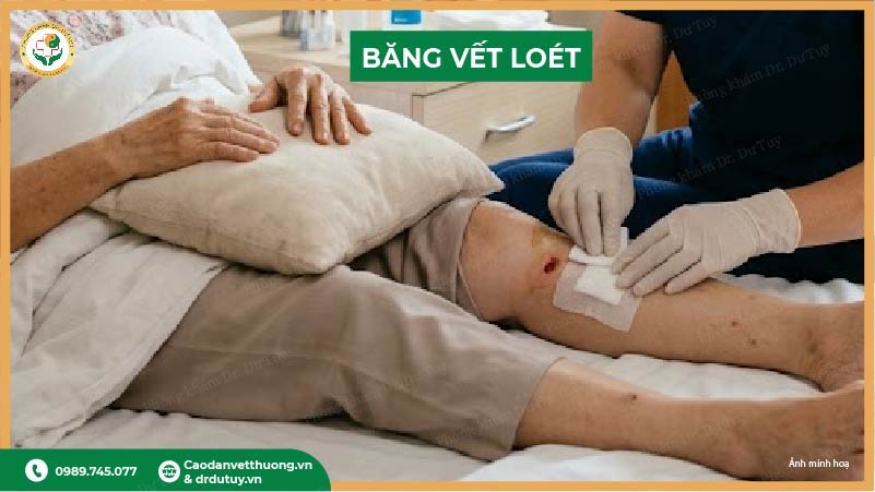 vết loét tì đè là gì?