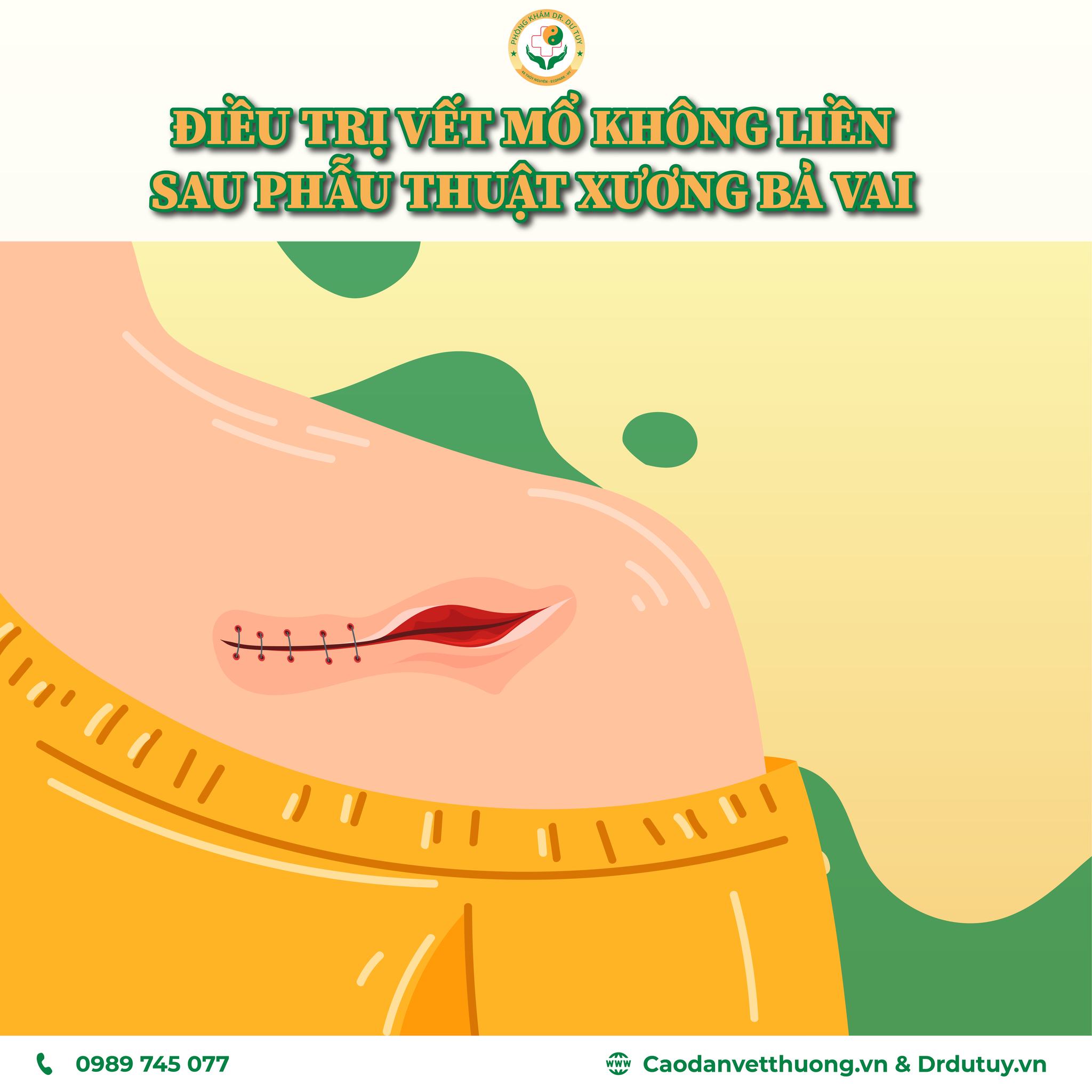 Vết Mổ Không Liền - Cách Điều Trị Đơn Giản Tại Nhà