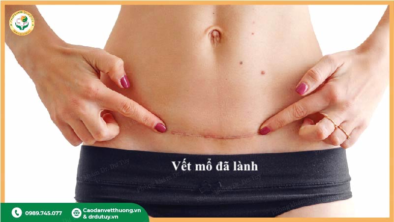vết mổ lành sau điều trị và chăm sóc