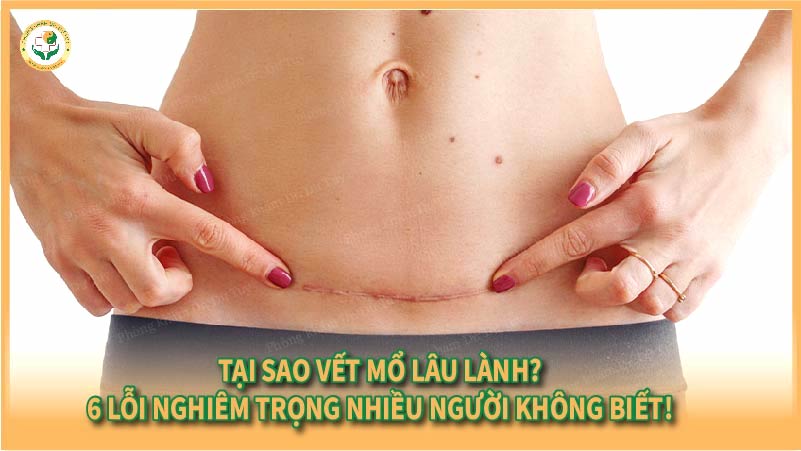 Tại sao vết mổ lâu lành? 6 lỗi nghiêm trọng nhiều người không biết!