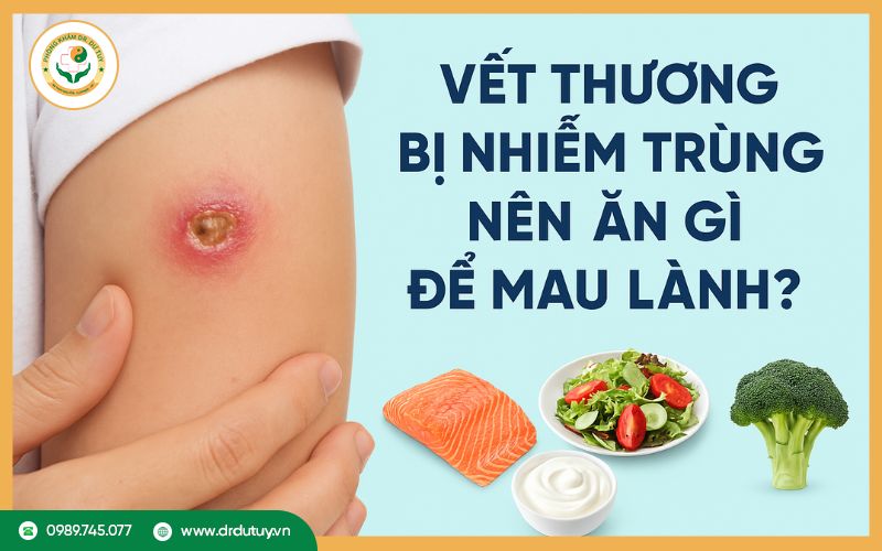 Vết thương bị nhiễm trùng nên ăn gì để mau lành?