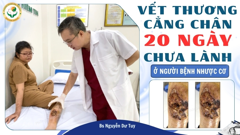 Vết thương cẳng chân 20 ngày chưa lành ở người bệnh nhược cơ: Hành trình hơn 30 ngày phục hồi