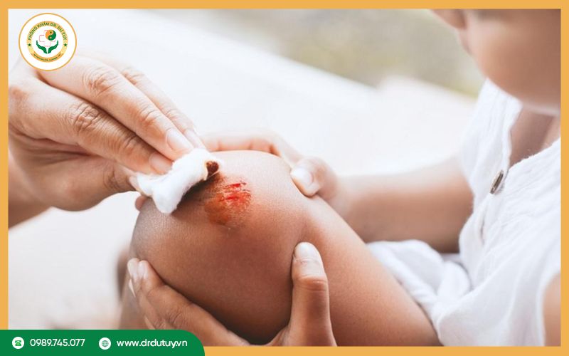 Vết thương chảy dịch vàng có sao không?