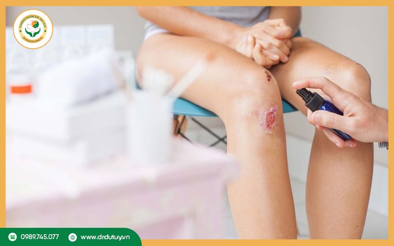 Khi nào cần gặp bác sĩ?