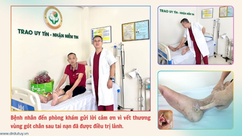vết thương gót chân sau tai nạn đã được điều trị lành