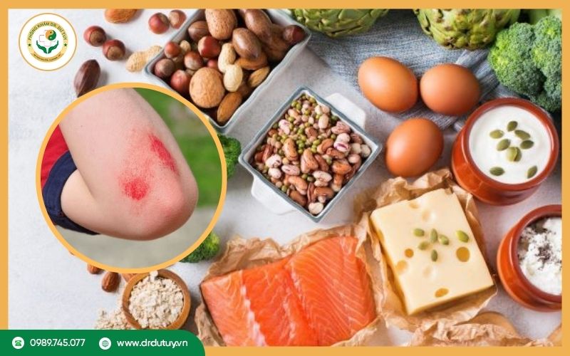 vết thương hở nên ăn gì?