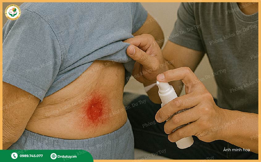 vết thương lâu lành, có mủ