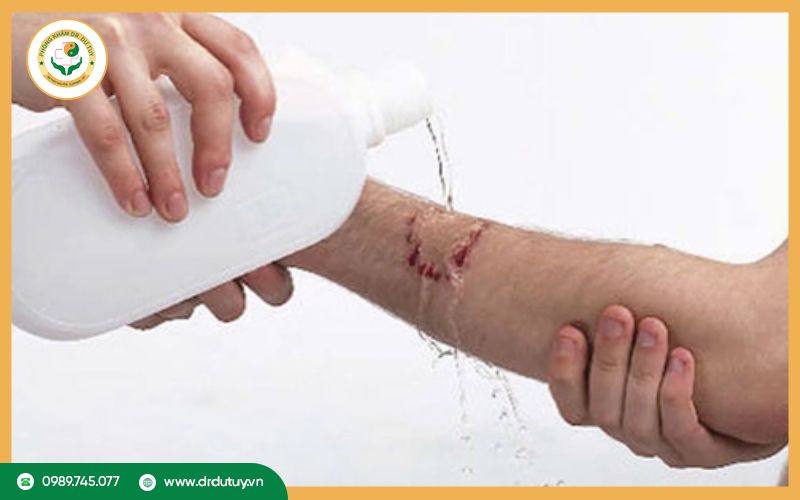 Nguyên nhân khiến vết loét không lành
