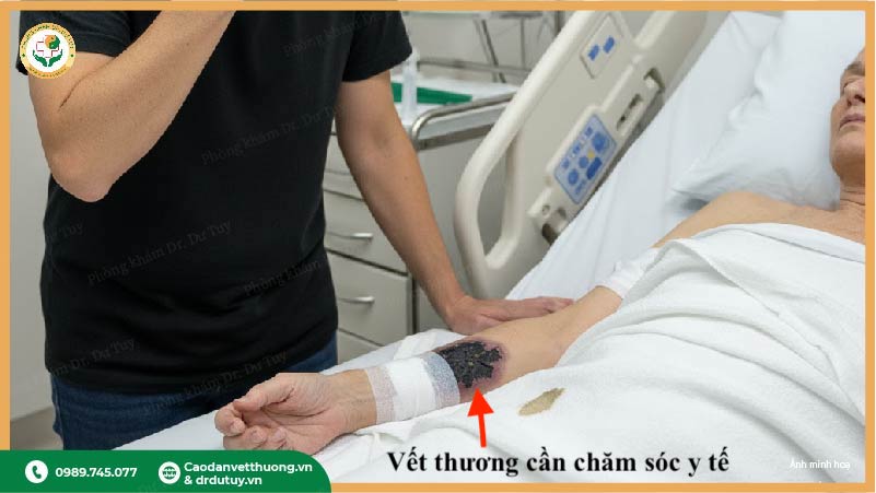 vết thương ngoài da cần chăm sóc y tế
