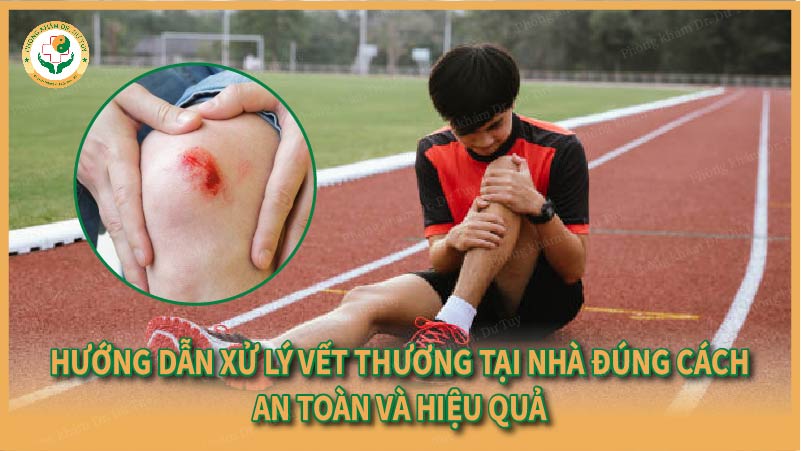 Hướng dẫn xử lý vết thương tại nhà đúng cách – An toàn và hiệu quả